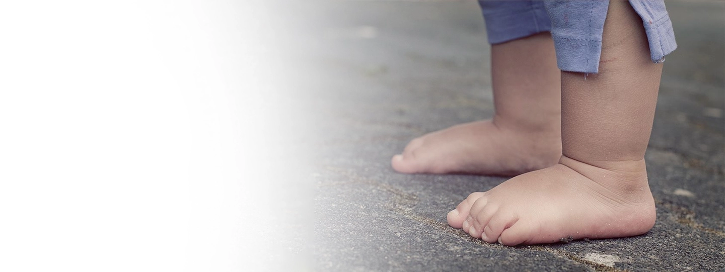 Flat Feet in Babies: Is It Normal or a Cause for Concern?